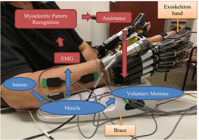 Advanced Myoelectric Control for Robotic Hand-Assisted Training: Outcome from a Stroke Patient